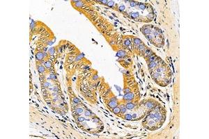 Immunohistochemistry (Paraffin-embedded Sections) (IHC (p)) image for anti-Lactotransferrin (LTF) antibody (ABIN7074457)