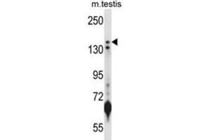 Western Blotting (WB) image for anti-Lysine (K)-Specific Demethylase 5B (KDM5B) antibody (ABIN2998014) (KDM5B antibody)
