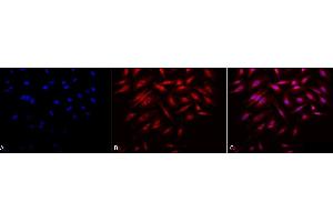 Immunocytochemistry/Immunofluorescence analysis using Rabbit Anti-Rab4 Polyclonal Antibody (ABIN361840 and ABIN361841). (Rab4 antibody  (C-Term))