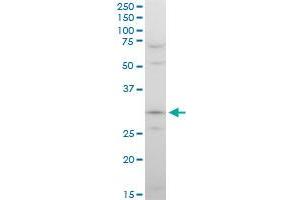 STOM polyclonal antibody (A01), Lot # 060717JCS1. (Stomatin antibody  (AA 59-142))