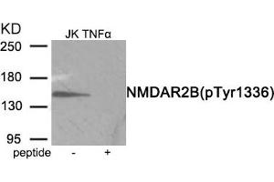 Western blot analysis of extracts from Jurkat cells treated with TNF using Phospho-NMDAR2B (Tyr1336) antibody. (GRIN2B antibody  (pTyr1336))