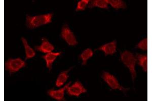 ABIN6266872 staining HepG2 by IF/ICC. (COL14A1 antibody  (C-Term))