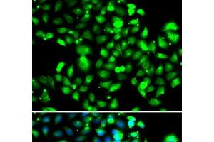 Immunofluorescence analysis of U2OS cells using GBP1 Polyclonal Antibody (GBP1 antibody)