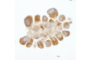 Immunohistochemistry (IHC) image for anti-DEAD (Asp-Glu-Ala-Asp) Box Polypeptide 3, X-Linked (DDX3X) (AA 1-50) antibody (ABIN7448520)