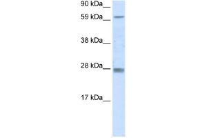 WB Suggested Anti-RHOX11 Antibody Titration:  0. (RHOX11 antibody  (N-Term))