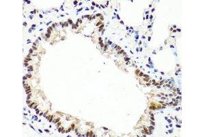 Immunohistochemistry of paraffin-embedded Rat lung using TET2 Polyclonal Antibody at dilution of 1:100 (40x lens). (TET2 antibody)