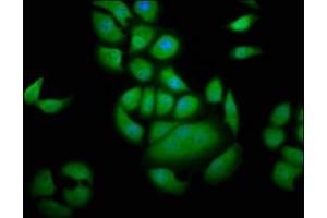 Immunofluorescence staining of A549 cells with ABIN7153757 at 1:133, counter-stained with DAPI. (GEMIN4 antibody  (AA 741-848))