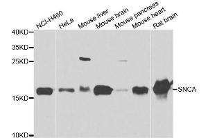 Western blot analysis of extracts of various cell lines, using SNCA antibody. (SNCA antibody)