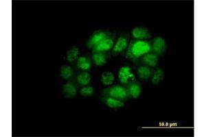 Immunofluorescence of monoclonal antibody to IRF5 on A-431 cell.
