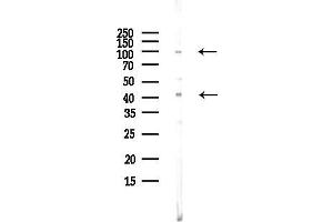 anti-Dystroglycan 1 (DAG1) (C-Term) antibody