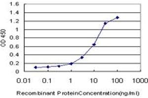 Detection limit for recombinant GST tagged ELAC1 is approximately 0. (ELAC1 antibody  (AA 282-362))