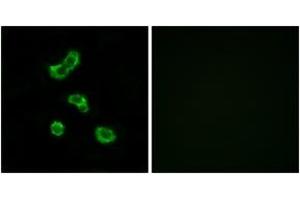 Immunofluorescence analysis of MCF7 cells, using CA5B Antibody. (CA5B antibody  (AA 241-290))