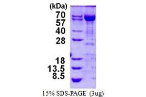 Image no. 1 for Transketolase (TKT) (AA 1-623) protein (His tag) (ABIN1098225)