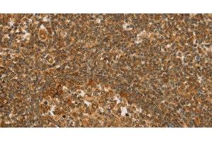 Immunohistochemistry of paraffin-embedded Human tonsil tissue using SLC6A3 Polyclonal Antibody at dilution 1:50 (SLC6A3 antibody)