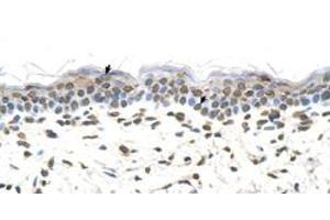 Immunohistochemical staining (Formalin-fixed paraffin-embedded sections) of human skin with FTCD polyclonal antibody  at 4-8 ug/mL working concentration. (FTCD antibody  (N-Term))