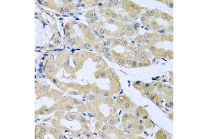 Immunohistochemistry of paraffin-embedded human stomach using HS1BP3 antibody at dilution of 1:100 (x40 lens). (HS1BP3 antibody)