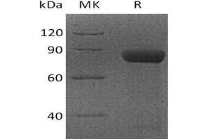 Cytotoxic and Regulatory T Cell Molecule (CRTAM) protein (Fc Tag)