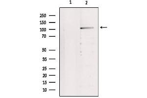 Western blot analysis of extracts from 293, using IDE Antibody.