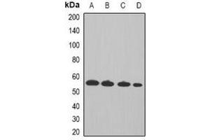 Western blot analysis of Cyclin A2 expression in Hela (A), MCF7 (B), mouse spleen (C), rat thymus (D) whole cell lysates.
