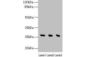Western blot All lanes: Nqo2 antibody at 8 μg/mL Lane 1: Rat heart tissue Lane 2: Mouse liver tissue Lane 3: Mouse kidney tissue Secondary Goat polyclonal to rabbit IgG at 1/10000 dilution Predicted band size: 27 kDa Observed band size: 27 kDa (NQO2 antibody  (AA 1-231))