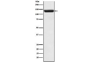 Western blot analysis of ZNF217 expression in Caco2 cell lysate.