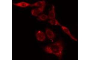 ABIN6275778 staining LOVO cells by IF/ICC. (KRT37,38 antibody)