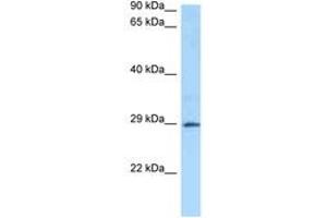 Image no. 1 for anti-Glutathione S-Transferase alpha 4 (GSTA4) (AA 23-72) antibody (ABIN6748201) (GSTA4 antibody  (AA 23-72))