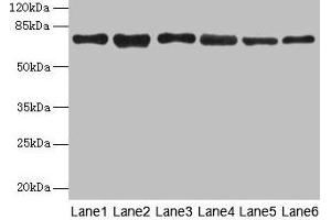 Western blot All lanes: TMCC1 antibody at 1 μg/mL Lane 1: MCF-7 whole cell lysate Lane 2: Mouse liver tissue Lane 3: Mouse kidney tissue Lane 4: HL60 whole cell lysate Lane 5: K562 whole cell lysate Lane 6: U937 whole cell lysate Secondary Goat polyclonal to rabbit IgG at 1/10000 dilution Predicted band size: 73, 54 kDa Observed band size: 73 kDa (TMCC1 antibody  (AA 51-300))