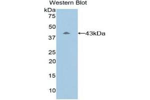Detection of Recombinant C8b, Mouse using Polyclonal Antibody to Complement Component 8b (C8b) (C8B antibody  (AA 161-503))