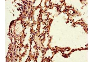 Immunohistochemistry of paraffin-embedded human lung tissue using ABIN7163786 at dilution of 1:100