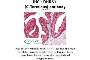 Image no. 2 for anti-Dehydrogenase/reductase (SDR Family) Member 7 (DHRS7) (C-Term) antibody (ABIN1733630) (DHRS7 antibody  (C-Term))