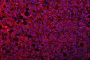 IF analysis of SEPTIN9 using anti-SEPTIN9 antibody (ABIN7600104). (Septin 9 antibody  (AA 15-282))