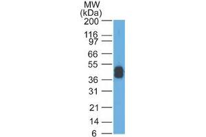 Western Blot Analysis of A431 cells using Cytokeratin, LMW Mouse Monoclonal Antibody (AE-1). (Keratin 77 antibody)