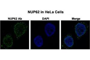 Immunofluorescent staining of HeLa cells with NUP62 polyclonal antibody  at 0.