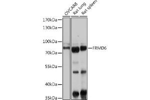 Western blot analysis of extracts of various cell lines, using FRMD6 antibody (ABIN6132194, ABIN6140773, ABIN6140774 and ABIN6225347) at 1:1000 dilution. (FRMD6 antibody  (AA 405-614))