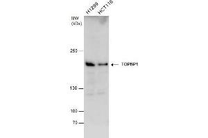 WB Image TOPBP1 antibody detects TOPBP1 protein by western blot analysis. (TOPBP1 antibody  (Internal Region))