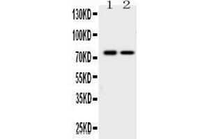 Western blot analysis of KCNQ1 expression in rat cardiac muscle extract ( Lane 1) and K562 whole cell lysates ( Lane 2). (KCNQ1 antibody  (Middle Region))