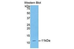 Western Blotting (WB) image for anti-CD3d Molecule, delta (CD3-TCR Complex) (CD3D) (AA 22-103) antibody (ABIN1175142)