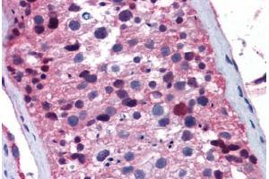 Human Testis: Formalin-Fixed, Paraffin-Embedded (FFPE) (FOXO1 antibody  (AA 373-422))