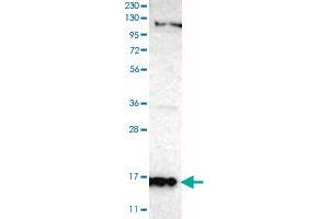 Western Blot analysis of RT-4 cell lysate with SNCG polyclonal antibody . (SNCG antibody)