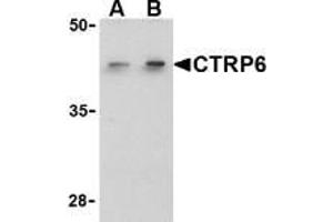 Western blot analysis of CTRP6 in HeLa cell lysate with AP30256PU-N CTRP6 antibody at (A) 1 and (B) 2 μg/ml. (CTRP6 antibody  (C-Term))