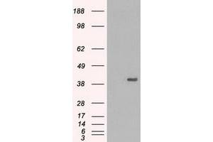 HEK293T cells were transfected with the pCMV6-ENTRY control (Left lane) or pCMV6-ENTRY MAPK1 (Right lane) cDNA for 48 hrs and lysed. (ERK2 antibody)