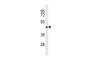 CWC27 Antibody (C-term) (ABIN1881243 and ABIN2843291) western blot analysis in MDA-M cell line lysates (35 μg/lane). (Cwc27 antibody  (C-Term))