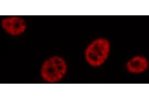 ABIN6267588 staining Hela by IF/ICC. (RUNX1 antibody  (pSer304))