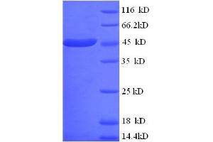 SDS-PAGE (SDS) image for Apolipoprotein A-IV (APOA4) (AA 21-395) protein (GST tag) (ABIN5709059) (APOA4 Protein (AA 21-395) (GST tag))