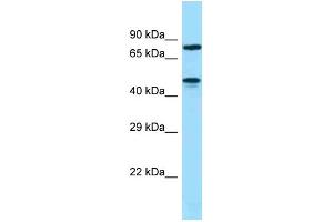 ZNF311 antibody  (N-Term)
