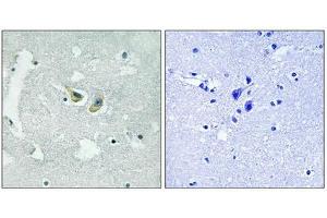 Immunohistochemical analysis of paraffin-embedded human brain tissue using p47 phox (Phospho-Ser345) antibody (left)or the same antibody preincubated with blocking peptide (right). (NCF1 antibody  (pSer345))