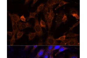 Immunofluorescence analysis of NIH-3T3 cells using VPS36 Polyclonal Antibody at dilution of 1:100 (40x lens). (VPS36 antibody)