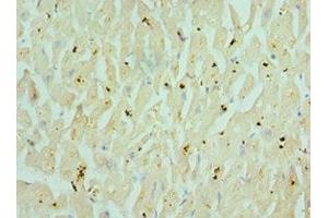 Immunohistochemistry of paraffin-embedded human heart tissue using ABIN7160351 at dilution of 1:100 (CHRM3 antibody  (AA 270-470))