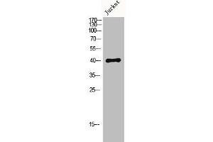 Western Blot analysis of Jurkat cells using MKP-1/2 Polyclonal Antibody (MKP-1/2 antibody)
